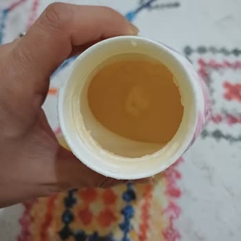 Aldığım Üç Bingo Yumuşatıcıda Katılaşma Sorunu Yaşadım, Çözüm Bekliyorum