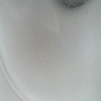 Vitra Klozetin Arızası Ve Garanti Kapsamında Değişim Talebi!