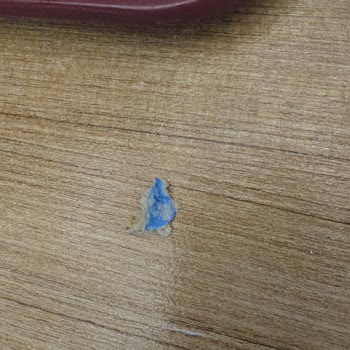 Burgerin İçinden Çıkan Plastik Eldiven Parçası Çocuğum İçin Büyük Tehlike Yarattı