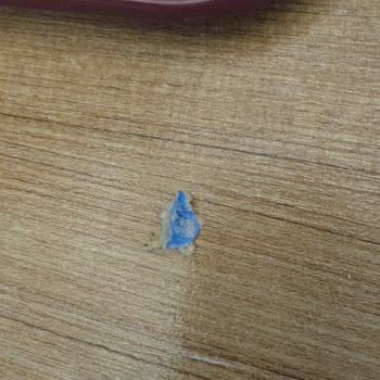 Burgerin İçinden Çıkan Plastik Eldiven Parçası Çocuğum İçin Büyük Tehlike Yarattı