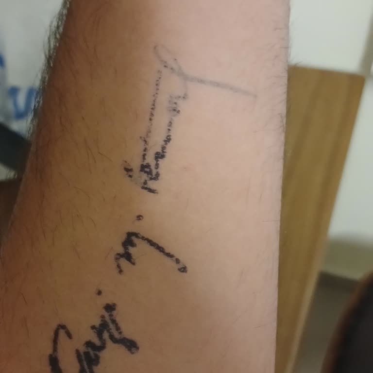 Instattoo Dövme 2. Günden Silinmeye Başladı!