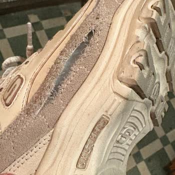 Az Kullanılan Skechers Ayakkabıda Yırtık Ve Müşteri Hizmetleri Hayal Kırıklığı