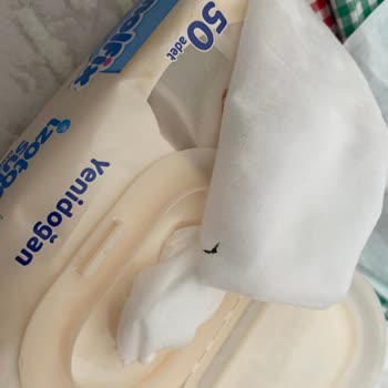 Yeni Doğan Islak Mendil Paketinden Siyah Parça Çıktı, Hijyen Endişesi Yaşıyorum