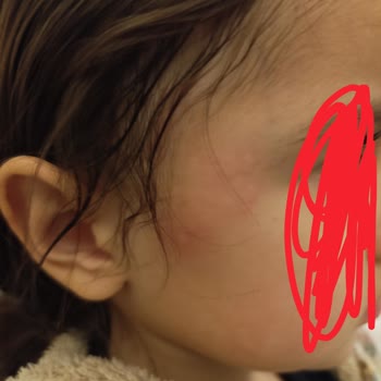 Oyun Hamurunda Alerjik Reaksiyon Ve Güvenlik Belgesi Eksikliği Endişesi