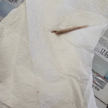 Hazır Gıdadan Çıkan Büyük Kemik Yüzünden Yaşanan Tehlikeli Kaza