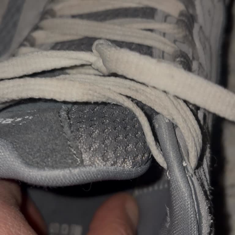 Skechers GO Run Modelinde Sol Ayakta Ağrı Ve Yetersiz İnceleme