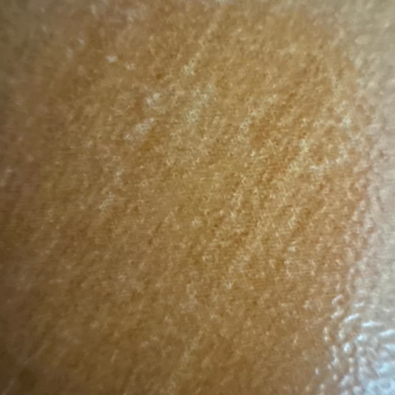 Üçay Mühendislik'in İhmali Nedeniyle Doğalgaz Bağlantımız Yapılmıyor, Mağduruz