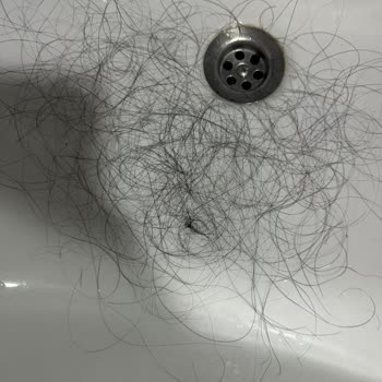 Saç Kaynak İşlemi Sonrası Dökülme Ve Kötü Müşteri Deneyimi