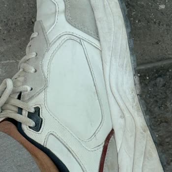 15 Gün İçinde Deforme Olan Ayakkabı İçin Çözüm Talebi