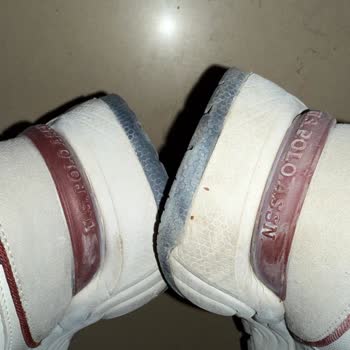 15 Gün İçinde Deforme Olan Ayakkabı İçin Çözüm Talebi