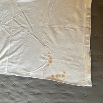 Bosch Çamaşır Makinesi Sürekli Pas Lekesi Sorunu Ve Çözüm Eksikliği