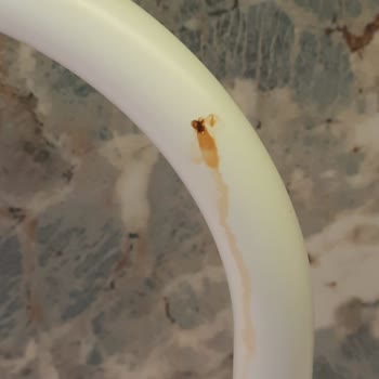 Bir Yıl İçinde Paslanan Batarya Ve Kale’den Yetersiz Çözüm