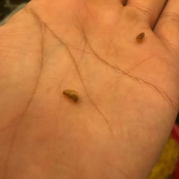 Indomie Hazır Noodle İçerisinden Kurt Çıkması ve Gıda Güvenliği Endişesi