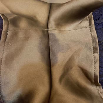 Kullanılmış Ve Lekeli Ürün Gönderimi Sonrası Yetersiz Çözüm Ve Hijyen Sorunu