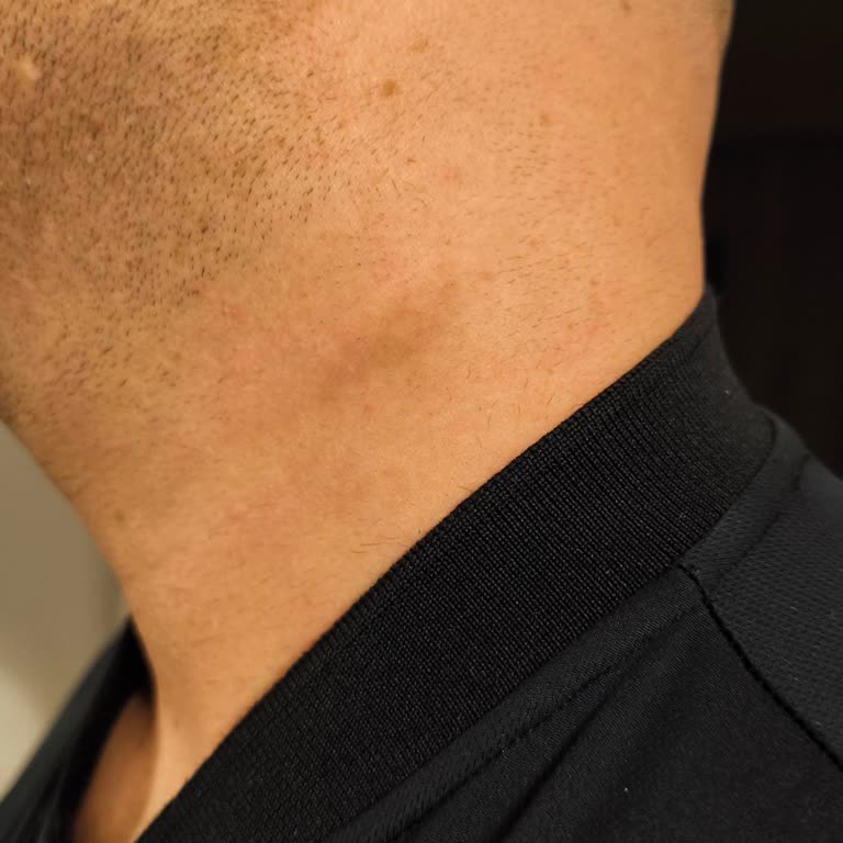 Yanlış Cihazla Yapılan Lazer Epilasyon Sonucu Kalıcı İz Ve Kıllanma Sorunu