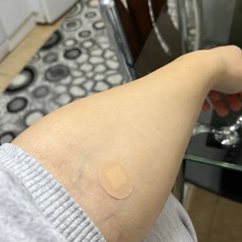 Sağlık Merkezinde Damar Yolu Açma Sırasında Yaşanan Kötü Deneyim Ve Personel Yetersizliği