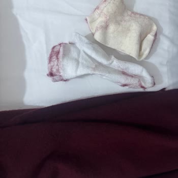 İlk Kullanımdan İtibaren Tüy Döken Atkı Ve Mağazadan Olumsuz İade Deneyimi