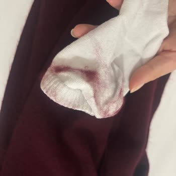 İlk Kullanımdan İtibaren Tüy Döken Atkı Ve Mağazadan Olumsuz İade Deneyimi