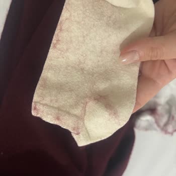 İlk Kullanımdan İtibaren Tüy Döken Atkı Ve Mağazadan Olumsuz İade Deneyimi