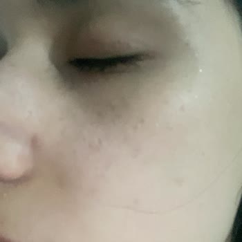 Estee Lauder Advanced Night Repair Serumu Cildimde Sivilce Ve Pütürlenme Yaptı