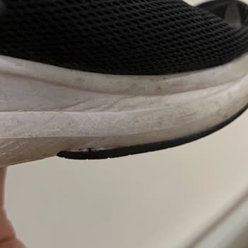 Kısa Sürede Deforme Olan Ayakkabıya Sıfır Destek!