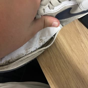 Kısa Sürede Deforme Olan Ayakkabı İçin Değişim Talebi Ve Mağaza Sürecinde Memnuniyetsizlik