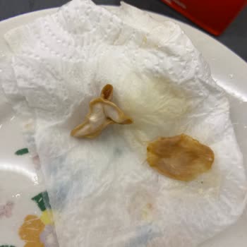 Şeftali Aromalı Meyve Suyunda Yabancı Madde Ve Gıda Güvenliği Endişesi