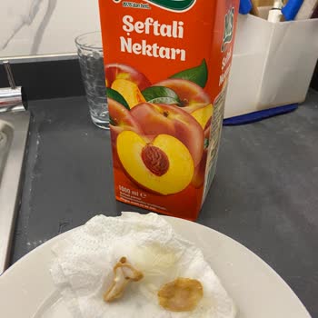 Şeftali Aromalı Meyve Suyunda Yabancı Madde Ve Gıda Güvenliği Endişesi