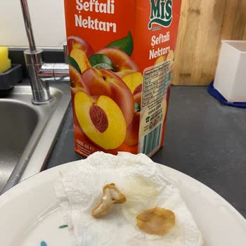 Şeftali Aromalı Meyve Suyunda Yabancı Madde Ve Gıda Güvenliği Endişesi