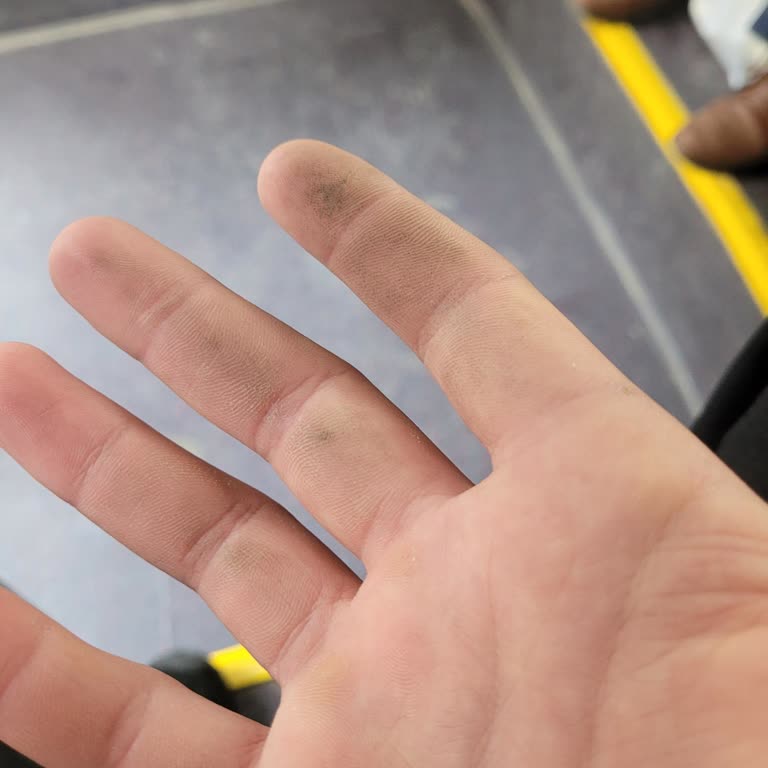 Elazığ Belediyesi Elbüs Hattında Hijyen Sorunu Ve Yetersiz Temizlik