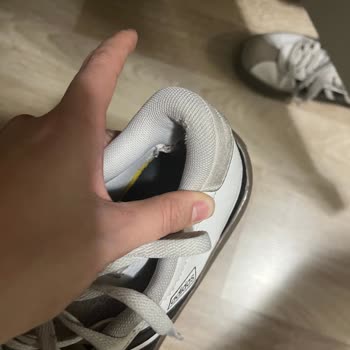 Adidas Ayakkabıda Kısa Sürede Ciddi Kalite Sorunu Ve Olumsuz Garanti Sonucu