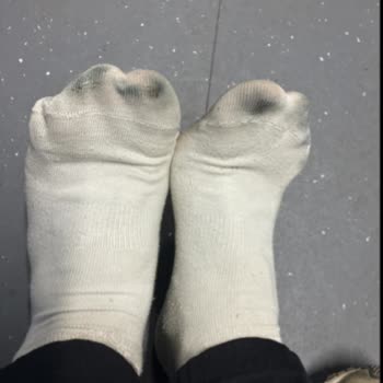 Skechers Ayakkabıda Renk Atması Ve Müşteri Hizmetleri Hayal Kırıklığı