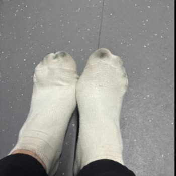 Skechers Ayakkabıda Renk Atması Ve Müşteri Hizmetleri Hayal Kırıklığı