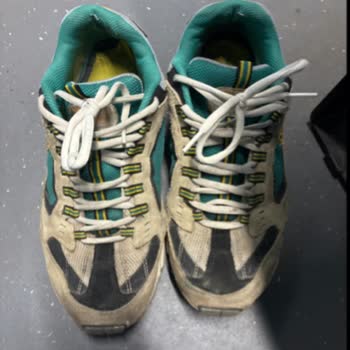 Skechers Ayakkabıda Renk Atması Ve Müşteri Hizmetleri Hayal Kırıklığı