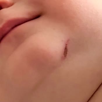 Köşeli Oyuncak Bebeğimi Yaraladı, Acil Önlem Alınmalı