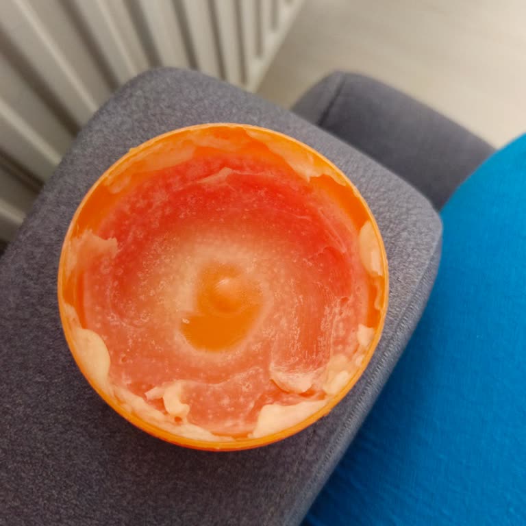 Kısa Sürede Bozulan Kaş Sabitleyici Nedeniyle Sağlık Ve Memnuniyet Endişesi