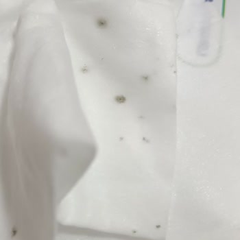 Tarihi Geçmemiş Temizlik Mendilinde Küf Şoku Ve Güven Kaybı