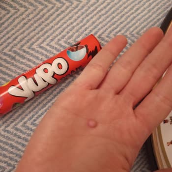 Çocuğumun Sağlığını Tehlikeye Atan Sert Madde Ve Ülker'den Cevap Alamama