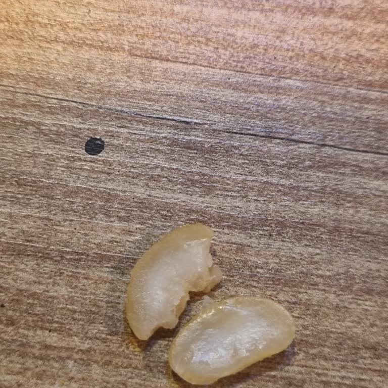 Reis Gıda Kuru Fasulye Pişmeme Sorunu Ve İade Talebi