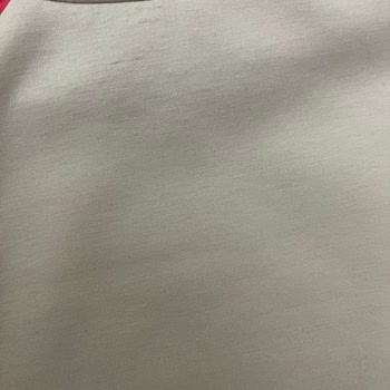 Kısa Sürede Deforme Olan Tunik Ve İlgisiz İnceleme Süreci