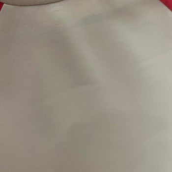 Kısa Sürede Deforme Olan Tunik Ve İlgisiz İnceleme Süreci