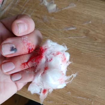 Sharkninja Türkiye Cam Sürahi Patladı, Yaralandım; Shark Ninja İlgisiz Kaldı