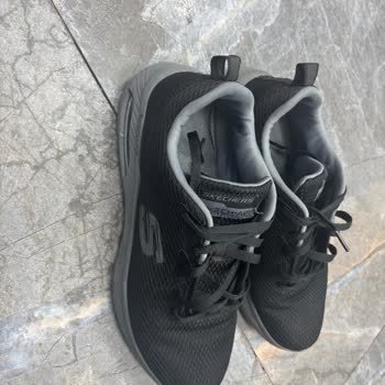 Aldığım Ayakkabı Ayağımda Yaralara Sebep Oldu, Mağduriyetim Giderilmedi