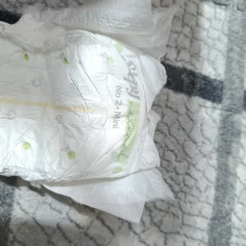 Bebek Bezinde Tanımsız Cisim Buldum, Sağlık Açısından Endişeliyim