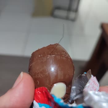 Ozmo Sürpriz Yumurtadan Saç Çıkması Hijyen Ve Güven Sorununa Yol Açtı