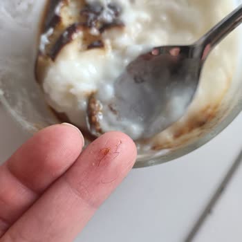 Liva Pastanesi | Livashop.com Hijyen Sorunu