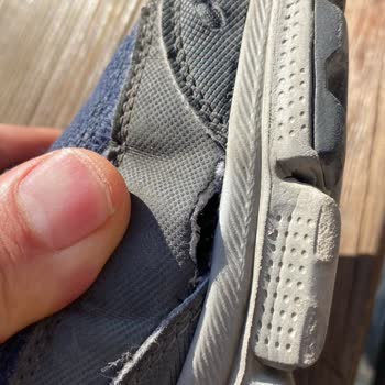 Skechers Ayakkabılarda Kısa Sürede Yanlarda Açılma Sorunu