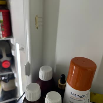 Vestel Buzdolabı Kapak Rafı Tırnaklarında Kronik Kırılma Sorunu Ve Mağduriyet