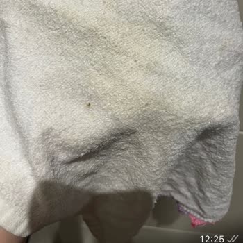 Bosch Çamaşır Makinesi Temizlik Sorunuyla Mağduriyet Yaşıyorum