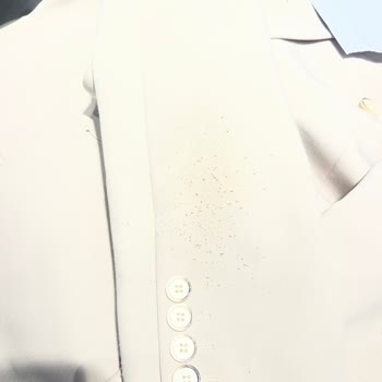 Bir Saatte Tüylenen Takım Elbise, Değişim Talebim Reddedildi!